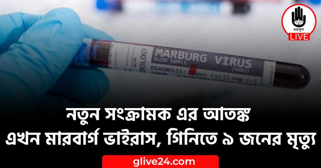 নতুন সংক্রামক এর আতঙ্ক এখন মারবার্গ ভাইরাস, গিনিতে ৯ জনের ‍মৃত্যু