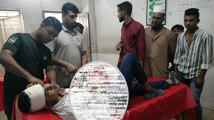 এসএসসি পরীক্ষার্থীকে কুপিয়েছে বান্ধবীরে বাবা 2 এসএসসি পরীক্ষার্থীকে কুপিয়েছে বান্ধবীরে বাবা