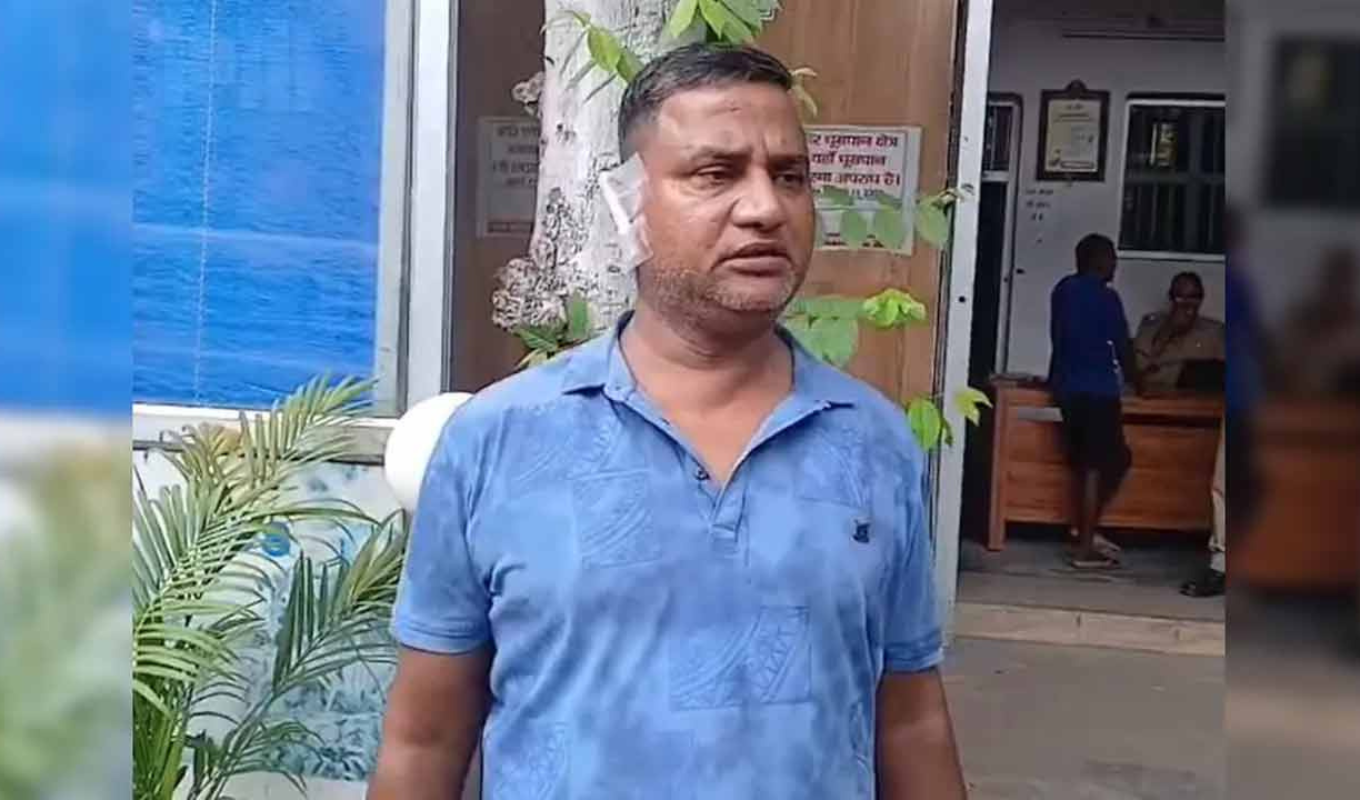 ভারতের উত্তর প্রদেশে দাম্পত্য কলহ: স্বামীর কান কামড়ে ছিঁড়ে নিলেন স্ত্রী