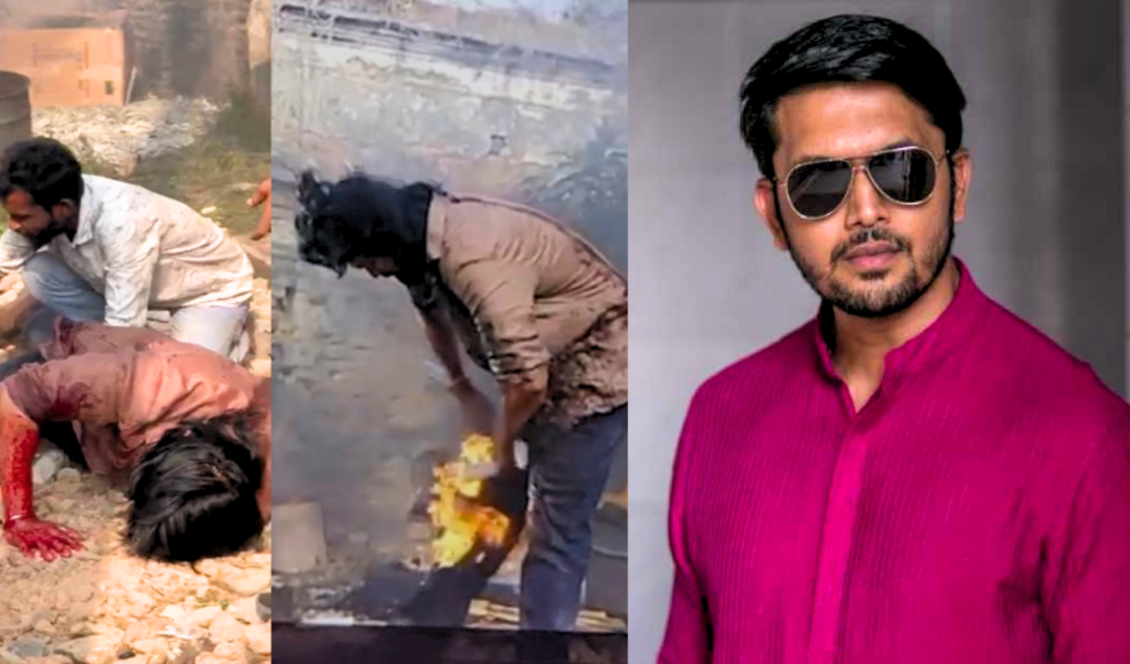 অগ্নিদগ্ধ চিত্রনায়ক আরিফিন শুভ অগ্নিদগ্ধ হয়েছেন নায়ক আরিফিন শুভ