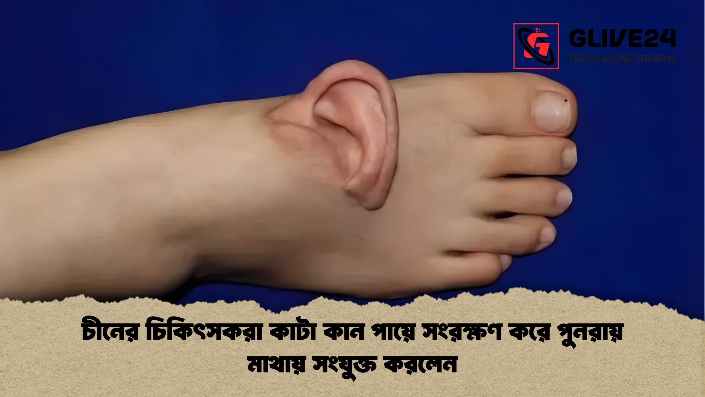 চীনের চিকিৎসকরা কাটা কান পায়ে সংরক্ষণ করে পুনরায় মাথায় সংযুক্ত করলেন চীনের চিকিৎসকরা কাটা কান পায়ে সংরক্ষণ করে পুনরায় মাথায় সংযুক্ত করলেন