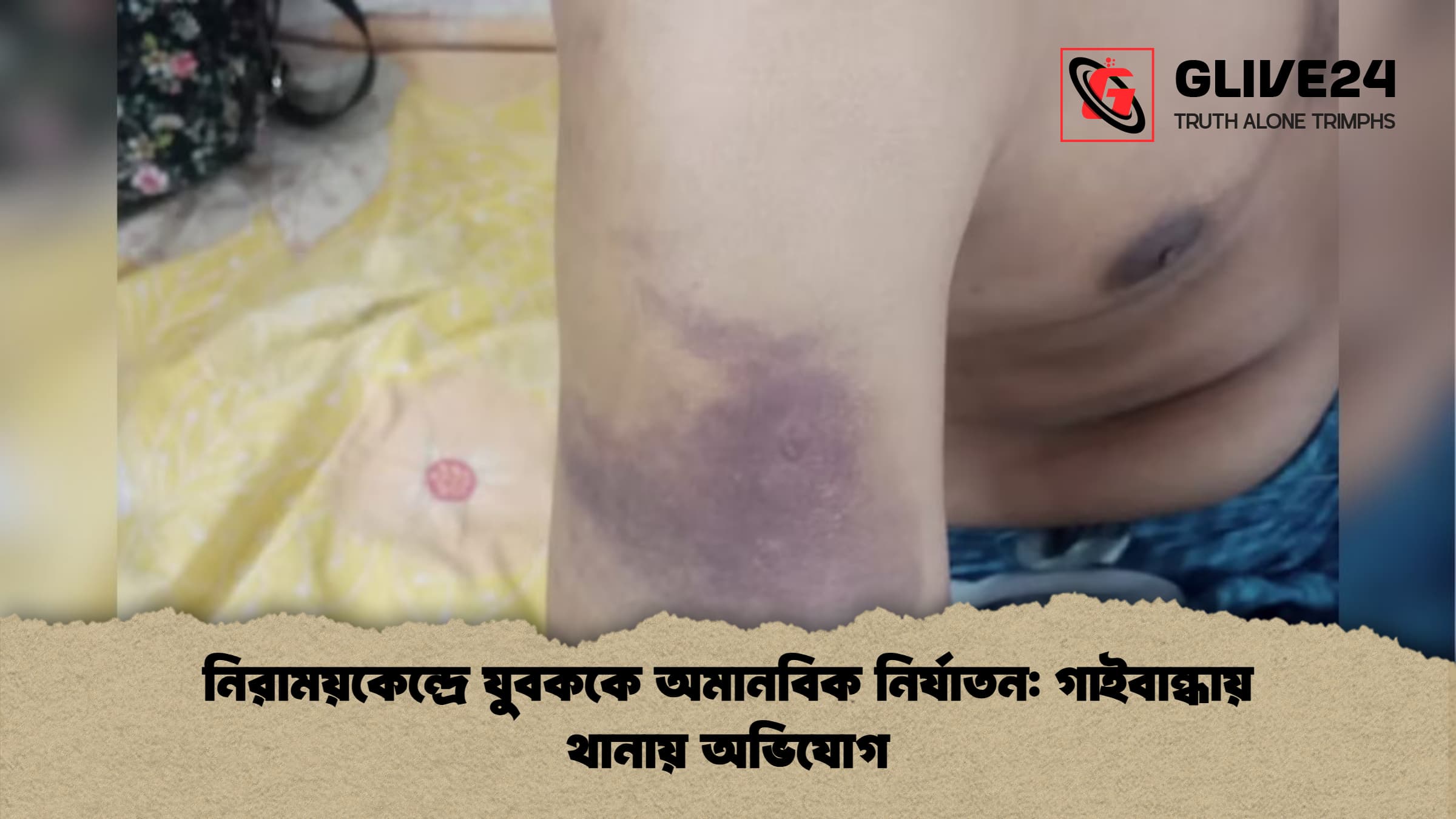 নিরাময়কেন্দ্রে যুবককে অমানবিক নির্যাতন: গাইবান্ধায় থানায় অভিযোগ