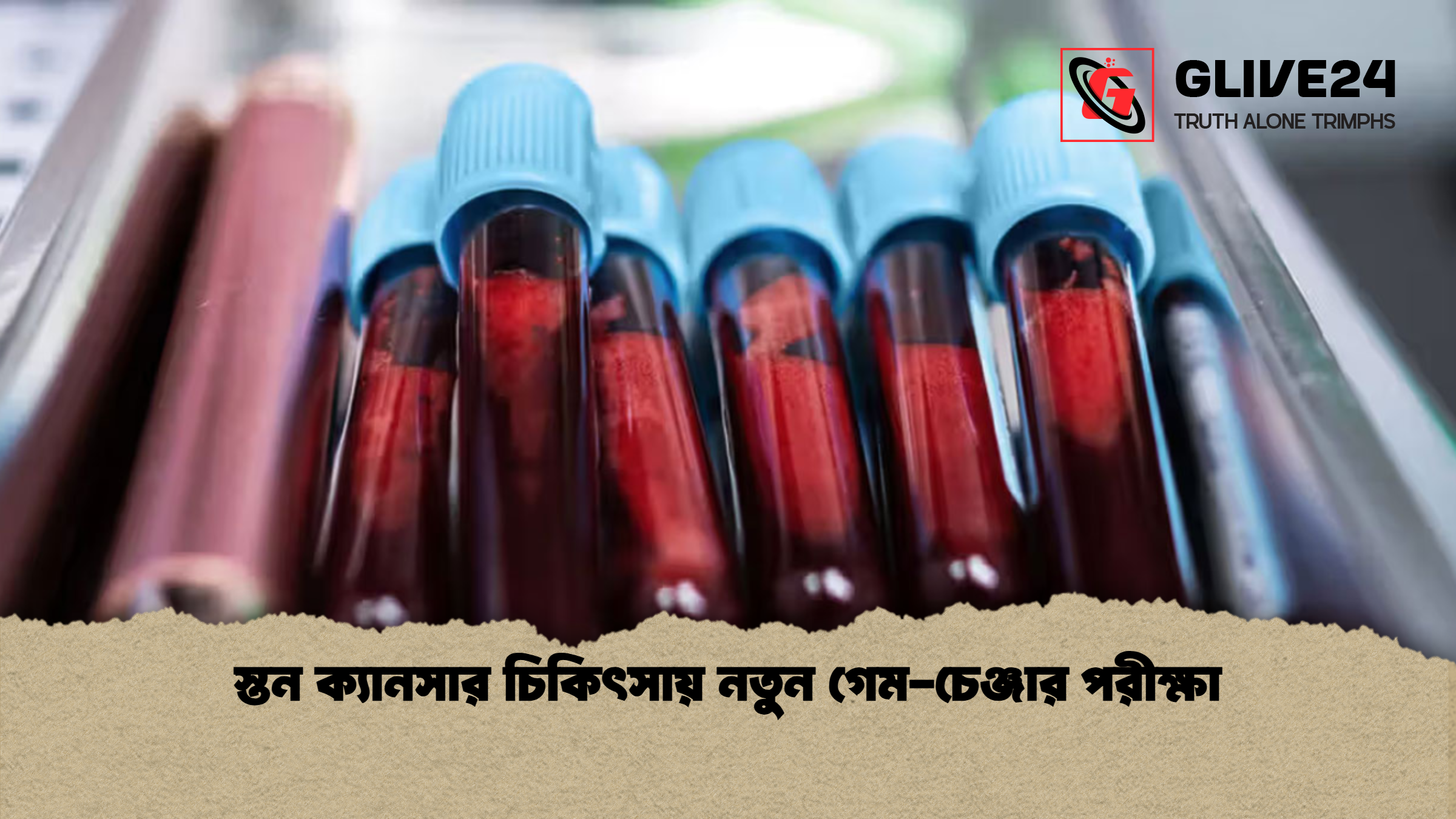 স্তন ক্যানসার চিকিৎসায় নতুন গেম চেঞ্জার পরীক্ষা স্তন ক্যানসার চিকিৎসায় নতুন গেম-চেঞ্জার পরীক্ষা