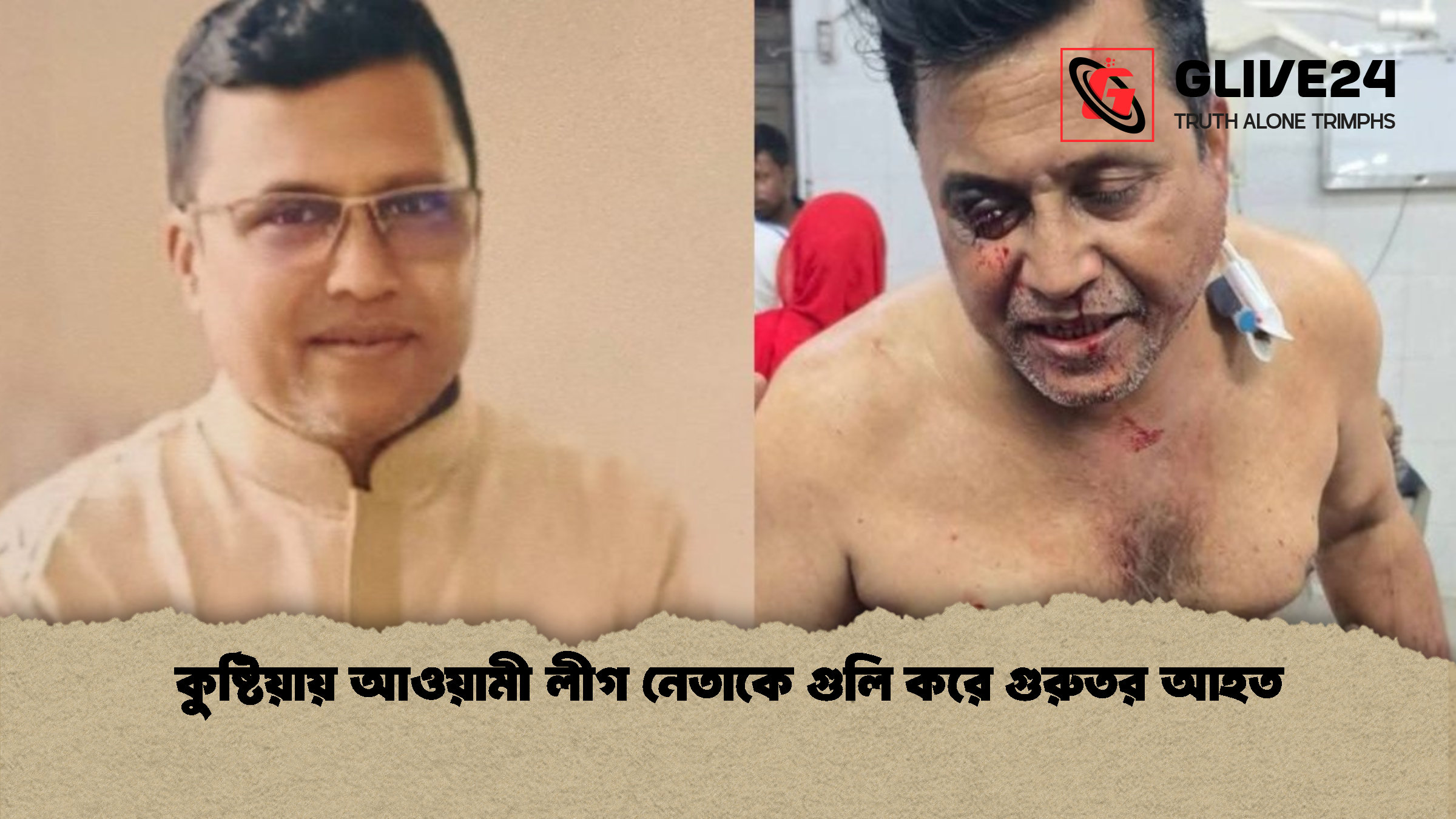 কুষ্টিয়ায় আওয়ামী লীগ নেতাকে গুলি করে গুরুতর আহত
