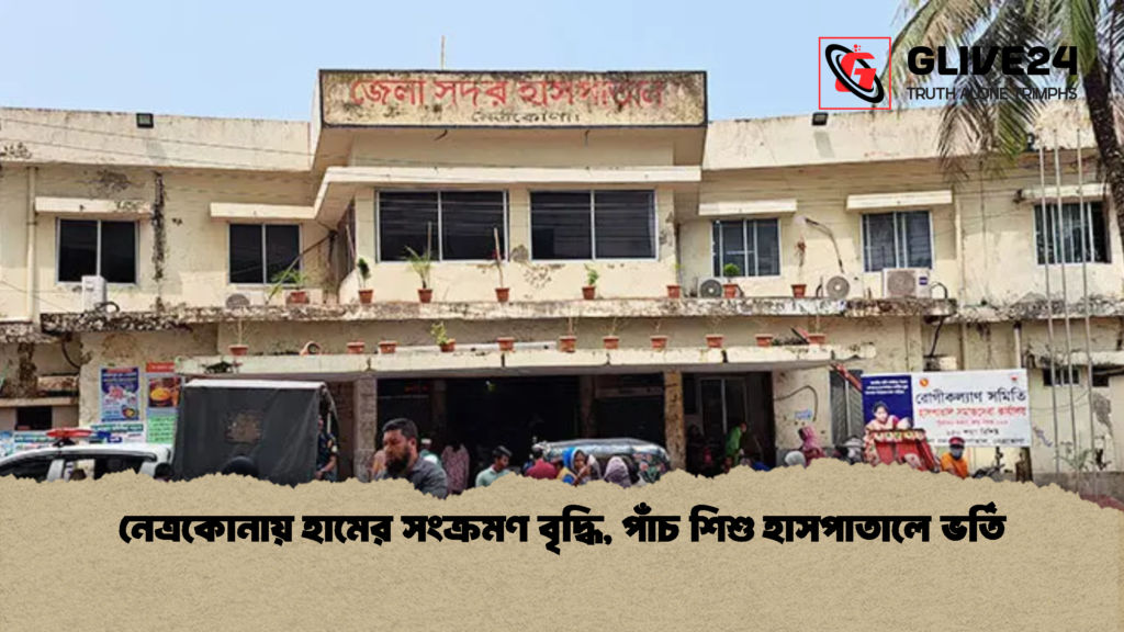 নেত্রকোনায় হামের সংক্রমণ বৃদ্ধি পাঁচ শিশু হাসপাতালে ভর্তি নেত্রকোনায় হামের সংক্রমণ বৃদ্ধি, পাঁচ শিশু হাসপাতালে ভর্তি