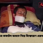 মাদ্রাসাছাত্র ককটেল বানাতে গিয়ে বিস্ফোরণে গুরুতর আহত