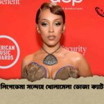 লিপেডেমা সন্দেহে খোলামেলা ডোজা ক্যাট