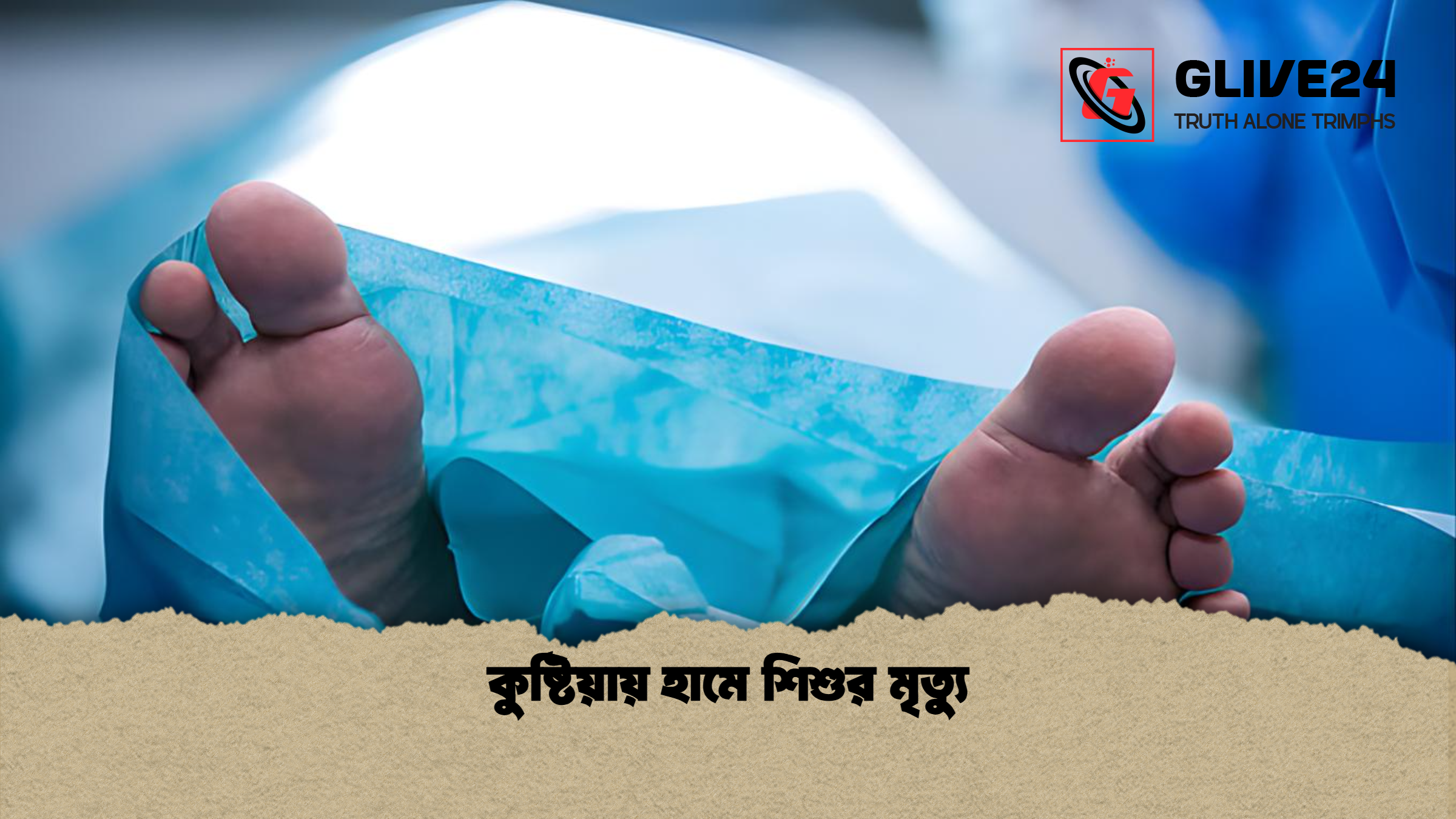 কুষ্টিয়ায় হামে শিশুর মৃত্যু