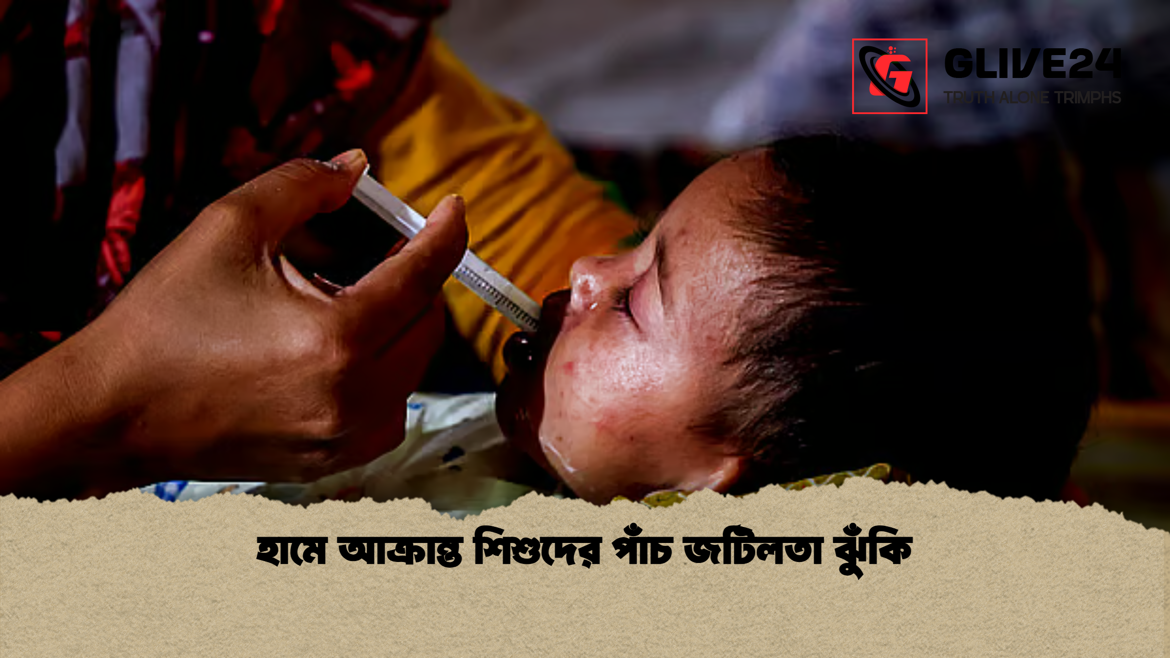 news thumbnail 1777361125359 হামে আক্রান্ত শিশুদের পাঁচ জটিলতা ঝুঁকি