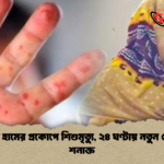 কুমিল্লায় হামের প্রকোপে শিশুমৃত্যু ২৪ ঘণ্টায় নতুন ৫০ রোগী শনাক্ত কুমিল্লায় হামের প্রকোপে শিশুমৃত্যু, ২৪ ঘণ্টায় নতুন ৫০ রোগী শনাক্ত