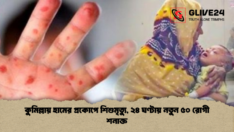 কুমিল্লায় হামের প্রকোপে শিশুমৃত্যু ২৪ ঘণ্টায় নতুন ৫০ রোগী শনাক্ত কুমিল্লায় হামের প্রকোপে শিশুমৃত্যু, ২৪ ঘণ্টায় নতুন ৫০ রোগী শনাক্ত
