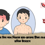 চট্টগ্রামে তিন লাখ শিশুকে হাম রুবেলা টিকা দেওয়া হবে চসিক উদ্যোগে চট্টগ্রামে তিন লাখ শিশুকে হাম-রুবেলা টিকা দেওয়া হবে চসিক উদ্যোগে