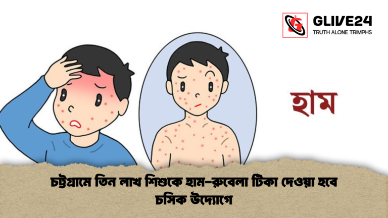 চট্টগ্রামে তিন লাখ শিশুকে হাম রুবেলা টিকা দেওয়া হবে চসিক উদ্যোগে চট্টগ্রামে তিন লাখ শিশুকে হাম-রুবেলা টিকা দেওয়া হবে চসিক উদ্যোগে