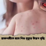 রাজশাহীতে হামে শিশু মৃত্যুর উদ্বেগ বৃদ্ধি রাজশাহীতে হামে শিশু মৃত্যুর উদ্বেগ বৃদ্ধি