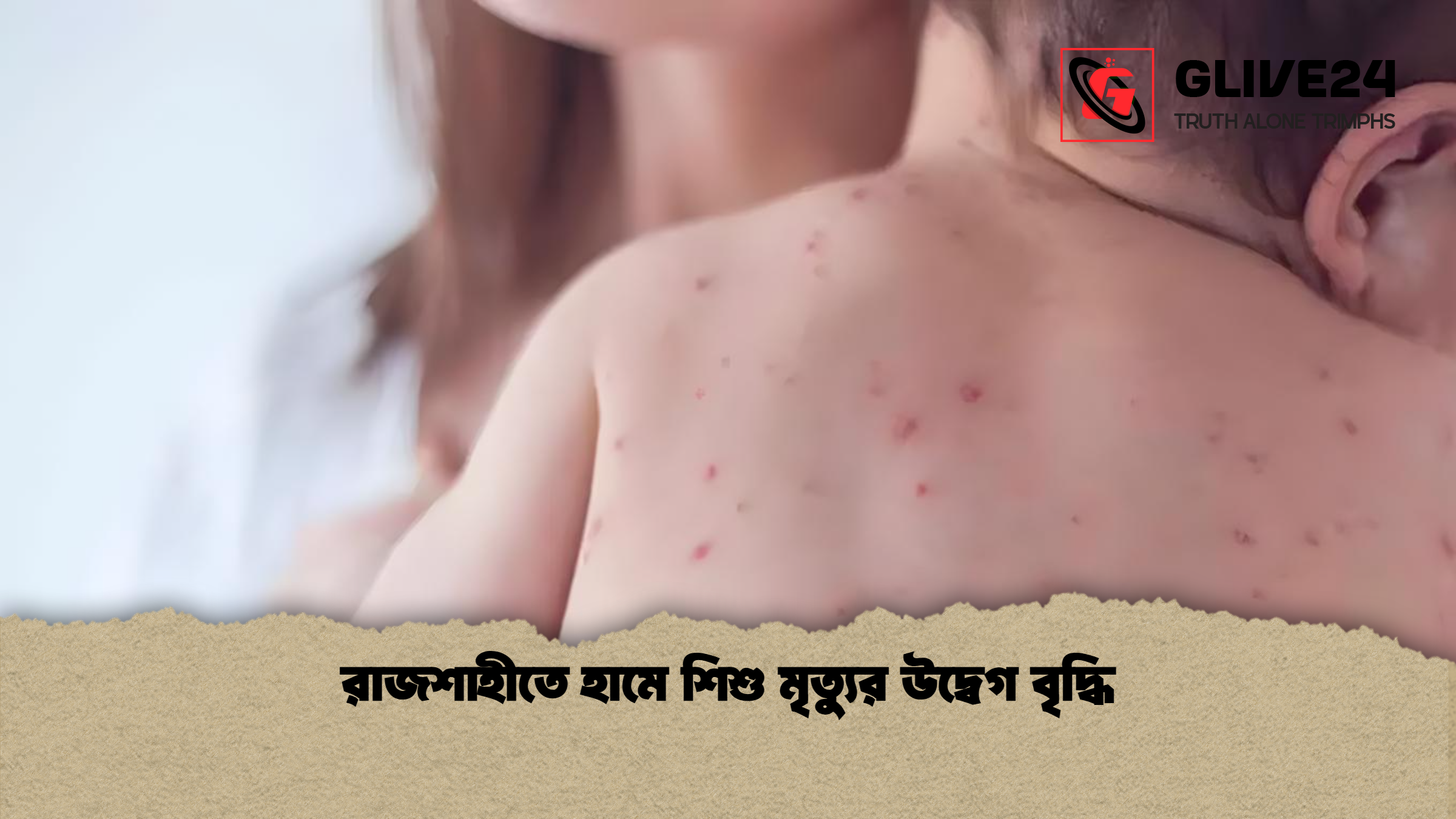 রাজশাহীতে হামে শিশু মৃত্যুর উদ্বেগ বৃদ্ধি রাজশাহীতে হামে শিশু মৃত্যুর উদ্বেগ বৃদ্ধি