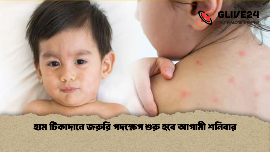 হাম টিকাদানে জরুরি পদক্ষেপ শুরু হবে আগামী শনিবার হাম টিকাদানে জরুরি পদক্ষেপ শুরু হবে আগামী শনিবার
