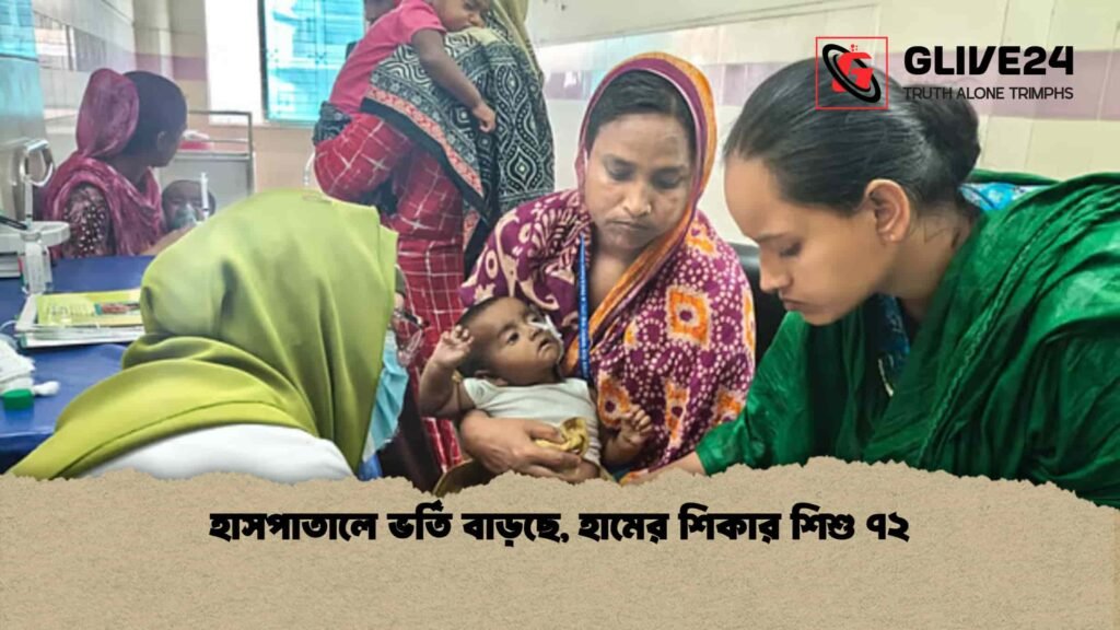 হাসপাতালে ভর্তি বাড়ছে, হামের শিকার ৭২ শিশু