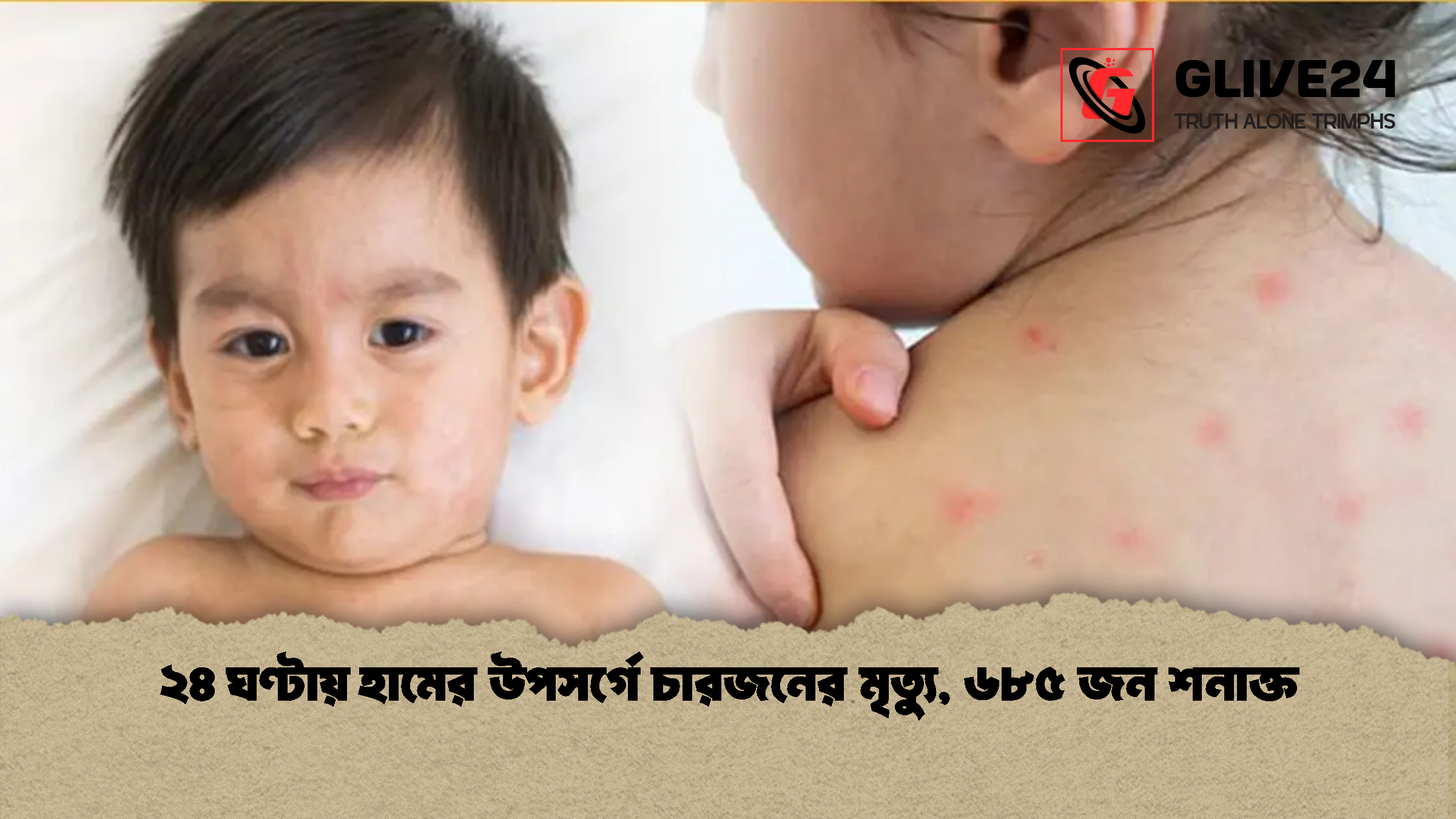 ২৪ ঘণ্টায় হামের উপসর্গে চারজনের মৃত্যু ৬৮৫ জন শনাক্ত ২৪ ঘণ্টায় হামের উপসর্গে চারজনের মৃত্যু, ৬৮৫ জন শনাক্ত