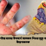 ২৪ ঘণ্টায় হামের উপসর্গে সাতজন শিশুর মৃত্যু বাড়ছে উদ্বেগজনক ২৪ ঘণ্টায় হামের উপসর্গে সাতজন শিশুর মৃত্যু বাড়ছে উদ্বেগজনক