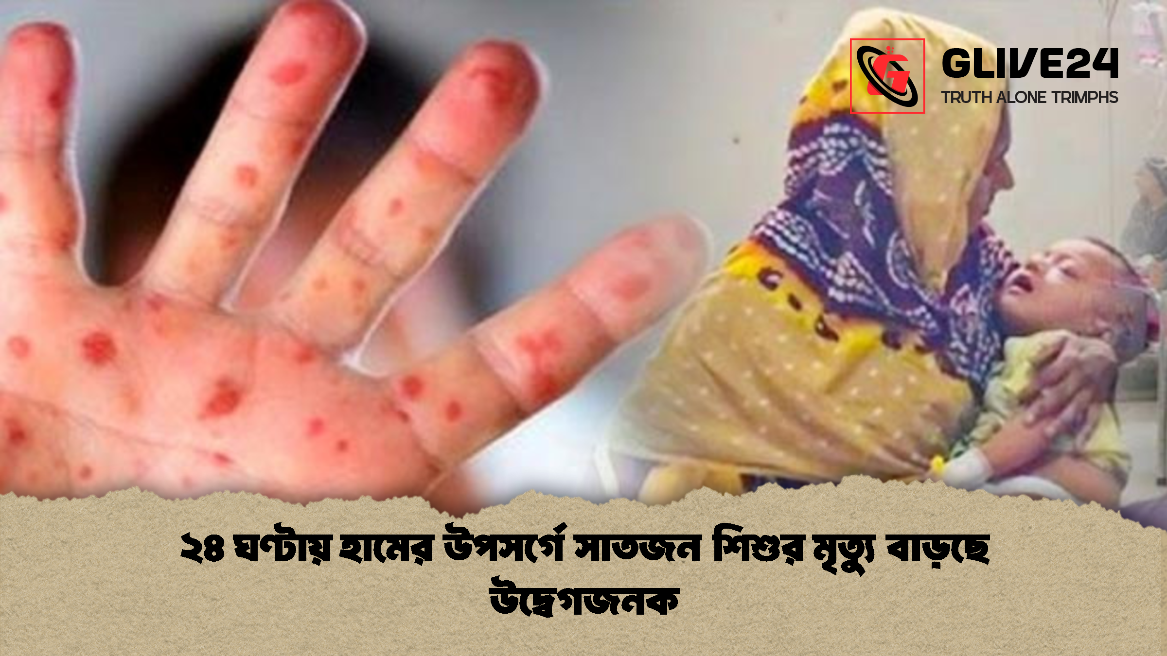 ২৪ ঘণ্টায় হামের উপসর্গে সাতজন শিশুর মৃত্যু বাড়ছে উদ্বেগজনক ২৪ ঘণ্টায় হামের উপসর্গে সাতজন শিশুর মৃত্যু বাড়ছে উদ্বেগজনক