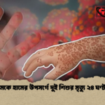 মমেকে হামের উপসর্গে দুই শিশুর মৃত্যু ২৪ ঘণ্টায় 1 মমেকে হামের উপসর্গে দুই শিশুর মৃত্যু ২৪ ঘণ্টায়