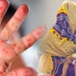 হাম ও হামের উপসর্গ নিয়ে আরও ১০ শিশুর মৃত্যু হাম ও হামের উপসর্গ নিয়ে দেশে আরও ১১ শিশুর মৃত্যু