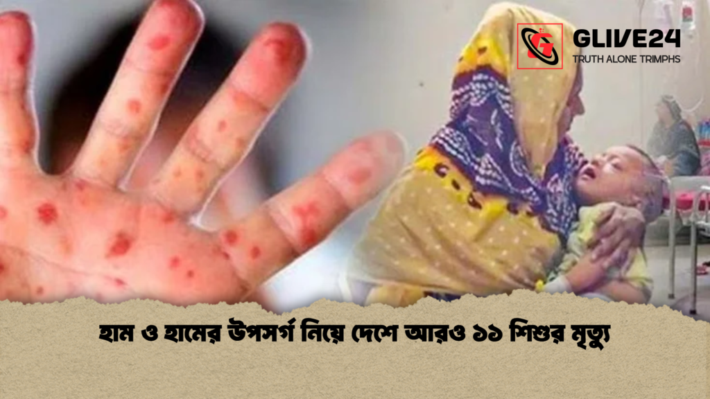 হাম ও হামের উপসর্গ নিয়ে দেশে আরও ১১ শিশুর মৃত্যু হাম ও হামের উপসর্গ নিয়ে দেশে আরও ১১ শিশুর মৃত্যু