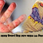 হাম ও হামের উপসর্গ নিয়ে দেশে আরও ১১ শিশুর মৃত্যু হাম ও হামের উপসর্গ নিয়ে দেশে আরও ১১ শিশুর মৃত্যু
