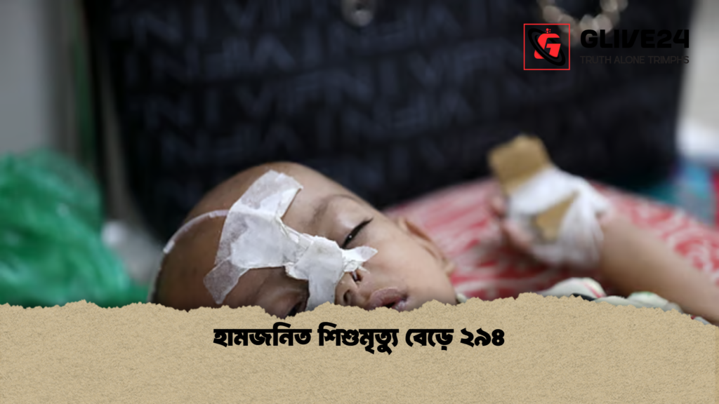 হামজনিত শিশুমৃত্যু বেড়ে ২৯৪ হামজনিত শিশুমৃত্যু বেড়ে ২৯৪