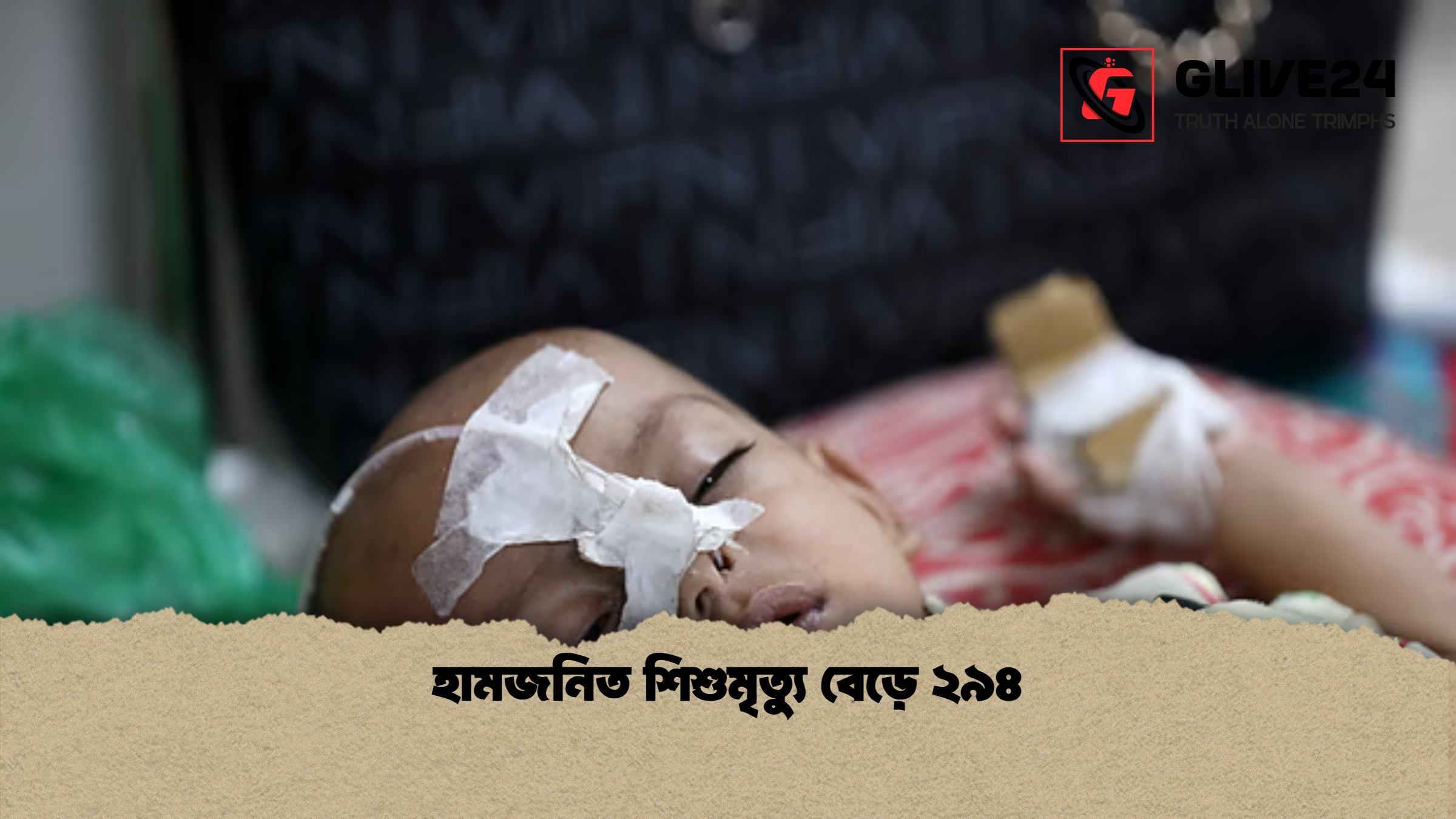 হামজনিত শিশুমৃত্যু বেড়ে ২৯৪ হামজনিত শিশুমৃত্যু বেড়ে ২৯৪