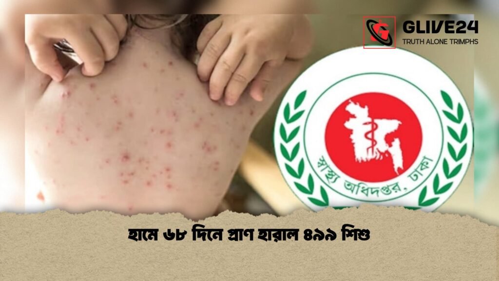 হামে ৬৮ দিনে প্রাণ হারাল ৪৯৯ শিশু 2 হামে ৬৮ দিনে প্রাণ হারাল ৪৯৯ শিশু
