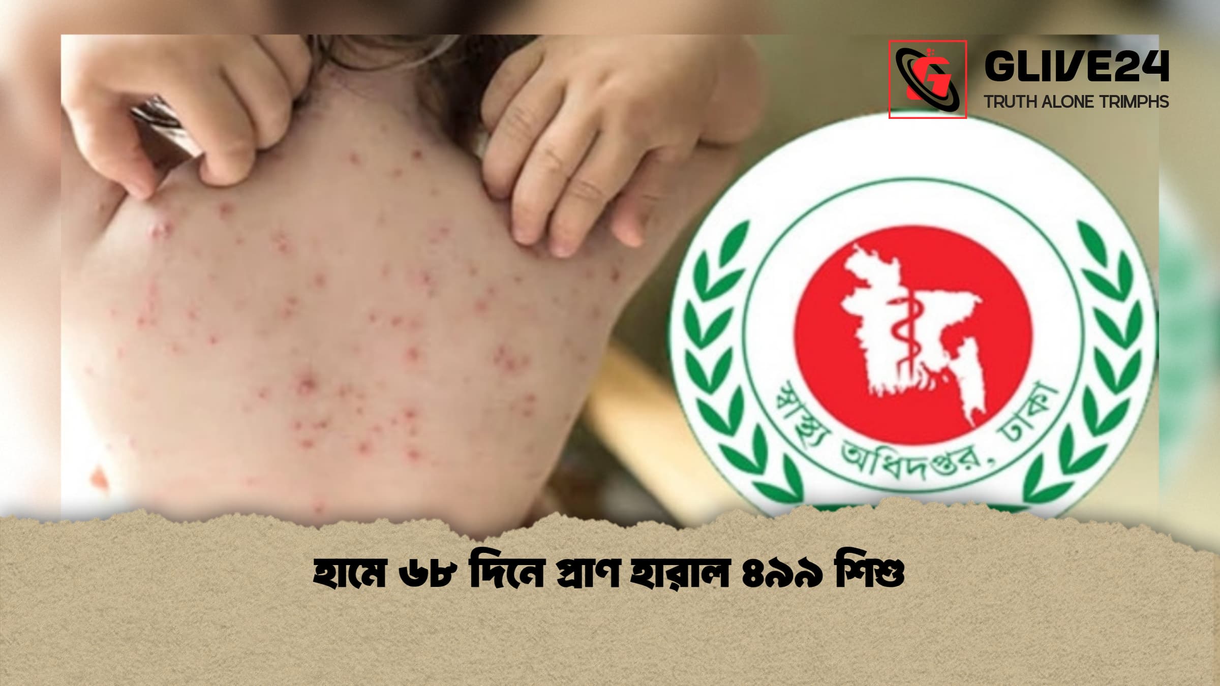 হামে ৬৮ দিনে প্রাণ হারাল ৪৯৯ শিশু 2 হামে ৬৮ দিনে প্রাণ হারাল ৪৯৯ শিশু