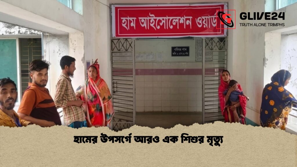 হামের উপসর্গে আরও এক শিশুর মৃত্যু 1 হামের উপসর্গে আরও এক শিশুর মৃত্যু
