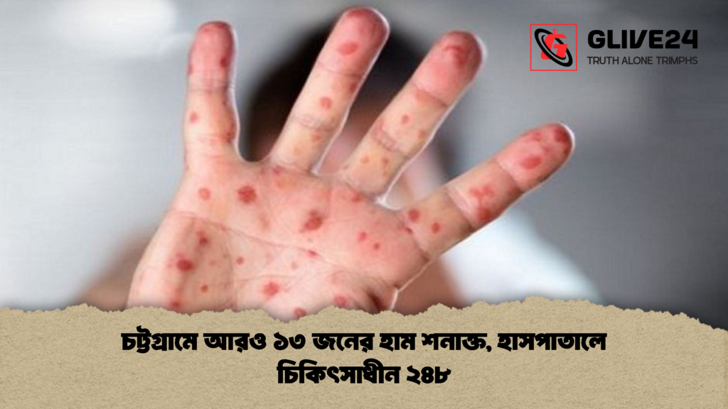 চট্টগ্রামে আরও ১৩ জনের হাম শনাক্ত, হাসপাতালে চিকিৎসাধীন ২৪৮ 2 চট্টগ্রামে আরও ১৩ জনের হাম শনাক্ত হাসপাতালে চিকিৎসাধীন ২৪৮ 1 চট্টগ্রামে আরও ১৩ জনের হাম শনাক্ত, হাসপাতালে চিকিৎসাধীন ২৪৮