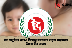 হাম প্রাদুর্ভাবে আরও শিশুমৃত্যু সংক্রমণ বাড়ছে সারাদেশে উদ্বেগ তীব্র রয়েছে