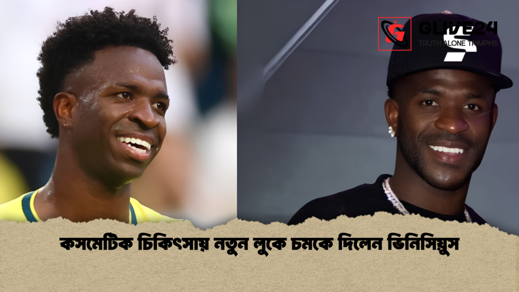 কসমেটিক চিকিৎসায় নতুন লুকে চমকে দিলেন ভিনিসিয়ুস 1 কসমেটিক চিকিৎসায় নতুন লুকে চমকে দিলেন ভিনিসিয়ুস