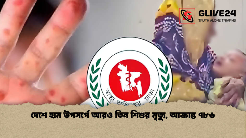 দেশে হাম উপসর্গে আরও তিন শিশুর মৃত্যু আক্রান্ত ৭৮৬ দেশে হাম উপসর্গে আরও তিন শিশুর মৃত্যু, আক্রান্ত ৭৮৬