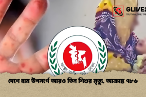 দেশে হাম উপসর্গে আরও তিন শিশুর মৃত্যু, আক্রান্ত ৭৮৬