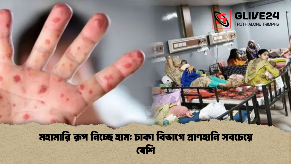 মহামারি রূপ নিচ্ছে হাম: ঢাকা বিভাগে প্রাণহানি সবচেয়ে বেশি 3 মহামারি রূপ নিচ্ছে হাম ঢাকা বিভাগে প্রাণহানি সবচেয়ে বেশি 2 মহামারি রূপ নিচ্ছে হাম: ঢাকা বিভাগে প্রাণহানি সবচেয়ে বেশি