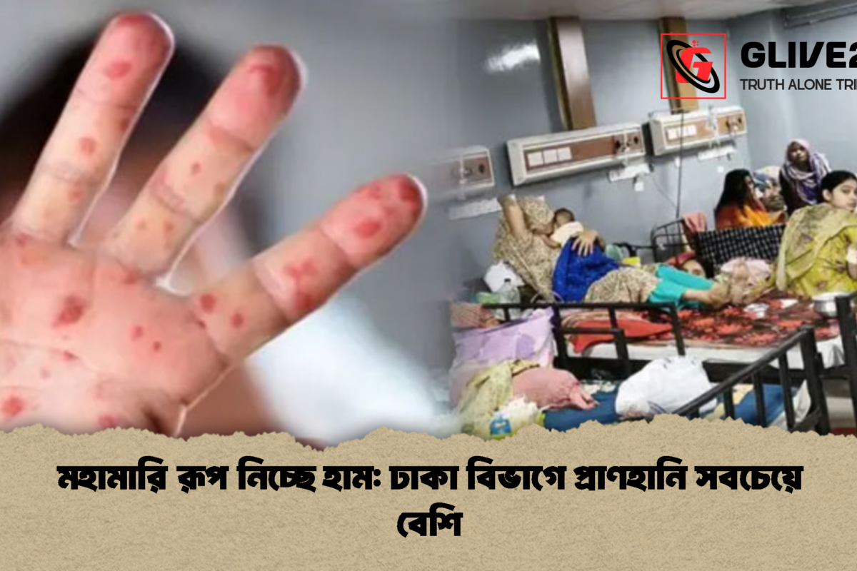 মহামারি রূপ নিচ্ছে হাম: ঢাকা বিভাগে প্রাণহানি সবচেয়ে বেশি