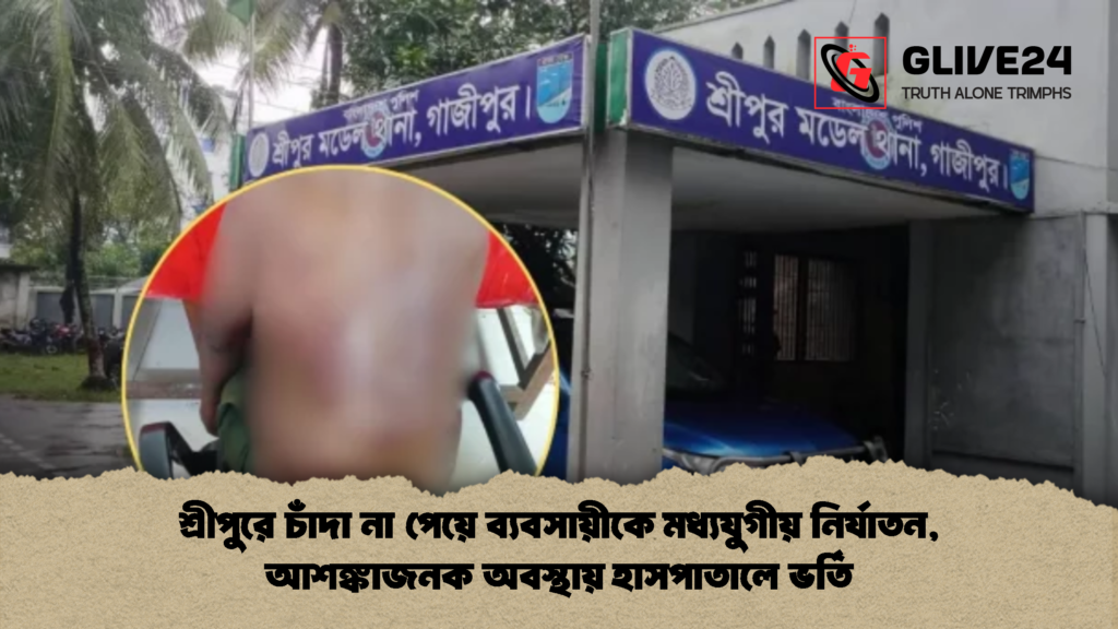 শ্রীপুরে চাঁদা না পেয়ে ব্যবসায়ীকে মধ্যযুগীয় নির্যাতন অবস্থায় হাসপাতালে ভর্তি শ্রীপুরে চাঁদা না পেয়ে ব্যবসায়ীকে মধ্যযুগীয় নির্যাতন, আশঙ্কাজনক অবস্থায় হাসপাতালে ভর্তি