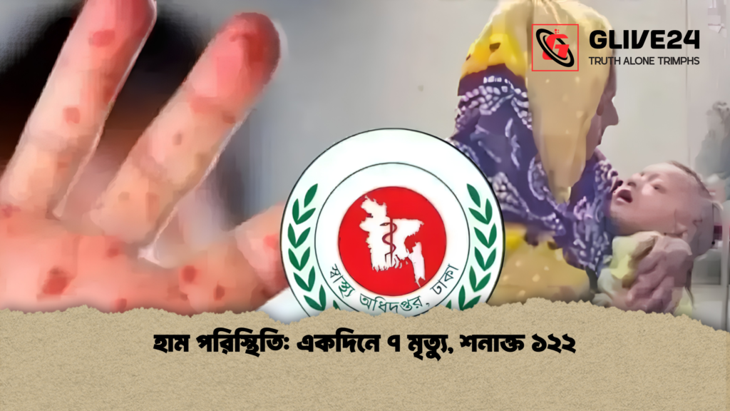 হাম পরিস্থিতি একদিনে ৭ মৃত্যু শনাক্ত ১২২ 1 হাম পরিস্থিতি: একদিনে ৭ মৃত্যু, শনাক্ত ১২২
