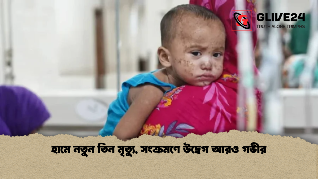 হামে নতুন তিন মৃত্যু সংক্রমণে উদ্বেগ আরও গভীর হামে নতুন তিন মৃত্যু, সংক্রমণে উদ্বেগ আরও গভীর