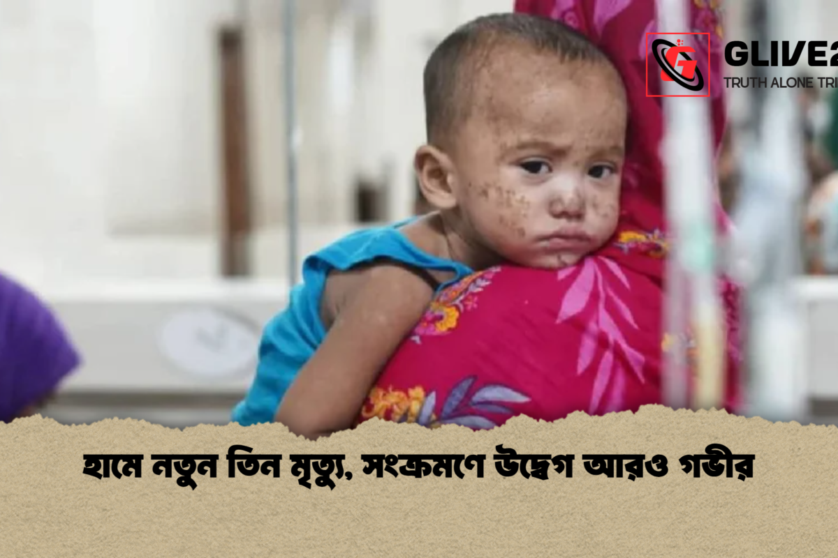 হামে নতুন তিন মৃত্যু, সংক্রমণে উদ্বেগ আরও গভীর