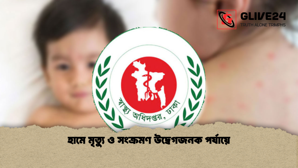 হামে মৃত্যু ও সংক্রমণ উদ্বেগজনক পর্যায়ে হামে মৃত্যু ও সংক্রমণ উদ্বেগজনক পর্যায়ে