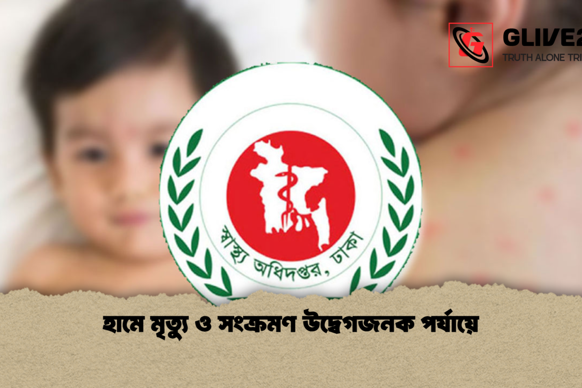 হামে মৃত্যু ও সংক্রমণ উদ্বেগজনক পর্যায়ে