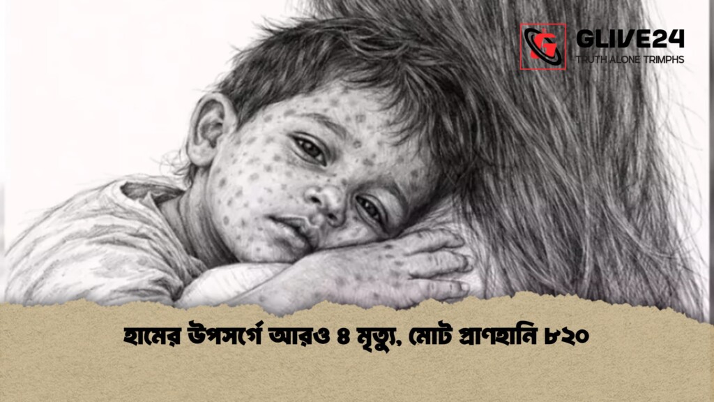 হামের উপসর্গে আরও ৪ মৃত্যু মোট প্রাণহানি ৮২০ 1 হামের উপসর্গে আরও ৪ মৃত্যু, মোট প্রাণহানি ৮২০