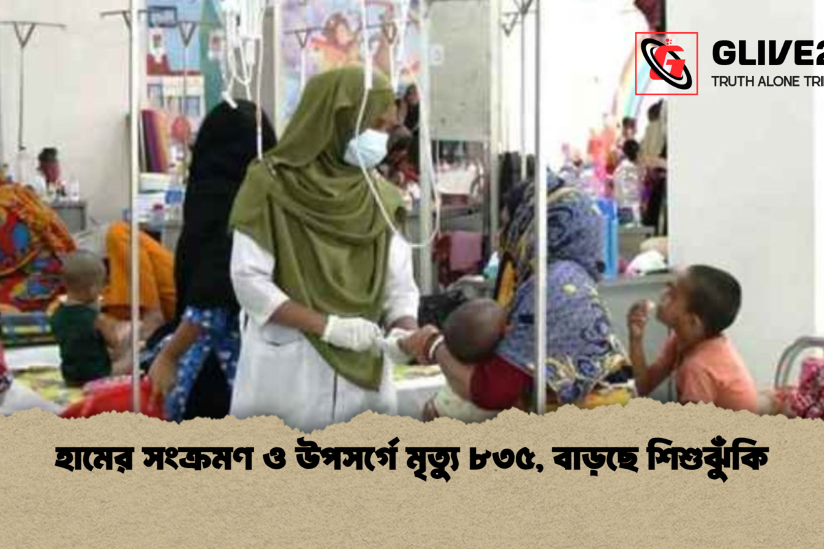 হামের সংক্রমণ ও উপসর্গে মৃত্যু ৮৩৫, বাড়ছে শিশুঝুঁকি