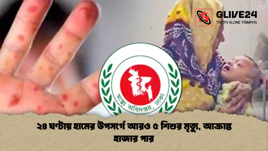 ২৪ ঘণ্টায় হামের উপসর্গে আরও ৫ শিশুর মৃত্যু আক্রান্ত হাজার পার 2 ২৪ ঘণ্টায় হামের উপসর্গে আরও ৫ শিশুর মৃত্যু, আক্রান্ত হাজার পার