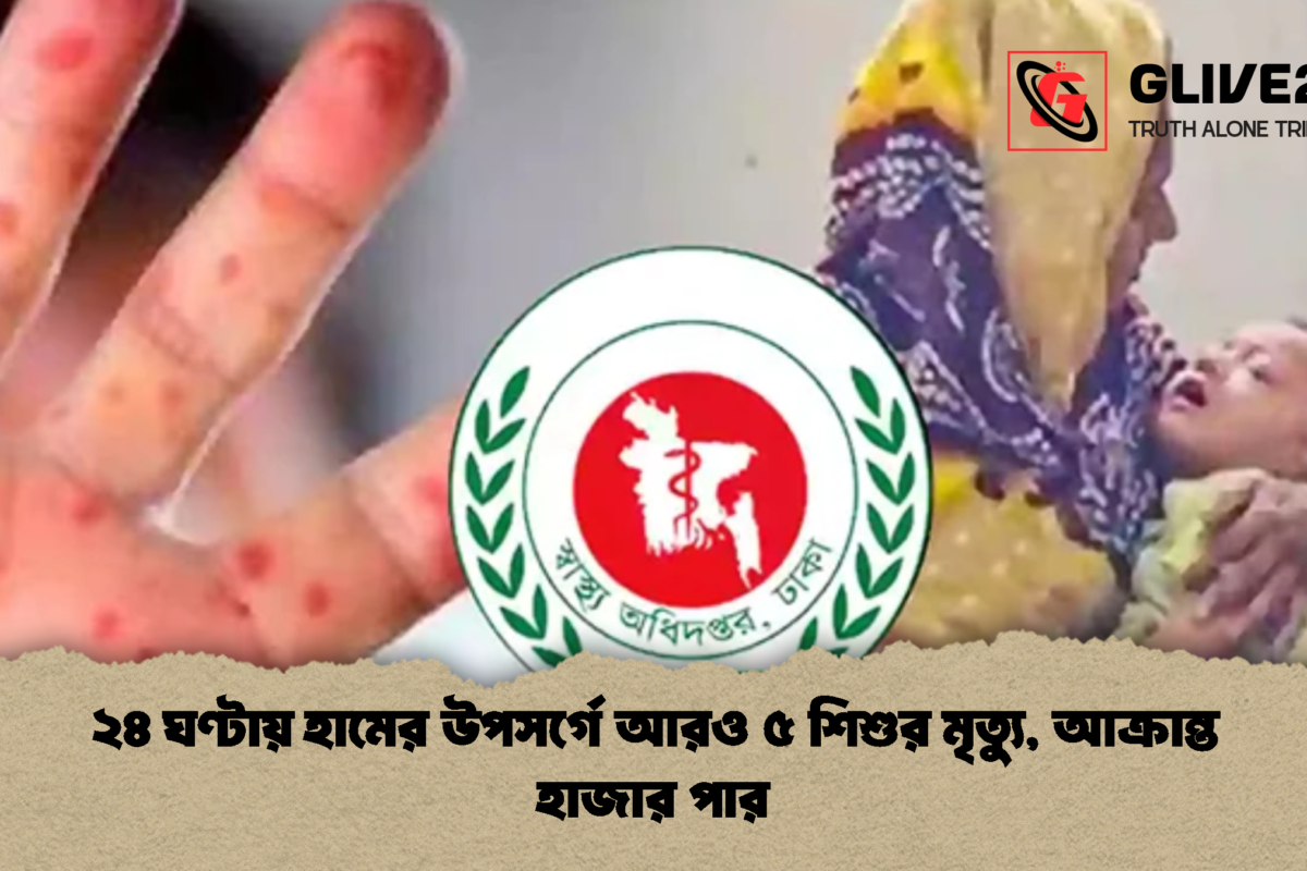 ২৪ ঘণ্টায় হামের উপসর্গে আরও ৫ শিশুর মৃত্যু, আক্রান্ত হাজার পার
